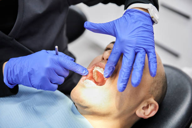 Best Chipped Tooth Repair Near Me  in Dayton, TX